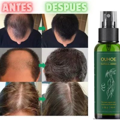 Activa el crecimiento desde la raíz con FollicX™ 😍